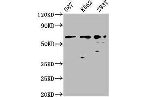 Western Blot Positive WB detected in: U87 whole cell lysate, K562 whole cell lysate, 293T whole cell lysate All lanes: ZNF37A antibody at 2. (ZNF37A 抗体  (AA 263-386))