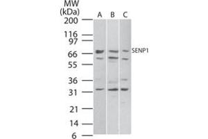 Western blot analysis of SENP1 in A) Daudi, B) HeLa and C) NIH/3T3 cell lysate. (SENP1 抗体  (AA 578-590))