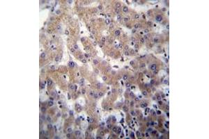 Immunohistochemistry analysis in formalin fixed and paraffin embedded human liver tissue reacted with POFUT2 Antibody (Center) followed which was peroxidase conjugated to the secondary antibody and followed by DAB staining.