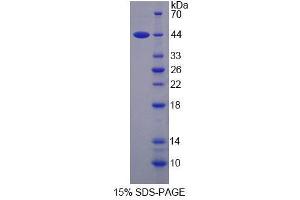 SDS-PAGE analysis of Human SMS Protein. (SMS 蛋白)
