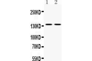 Western blot analysis of ABL2 expression in mouse brain extract ( Lane 1) and HELA whole cell lysates ( Lane 2). (ABL2 抗体  (AA 1065-1182))