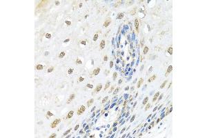 Immunohistochemistry of paraffin-embedded human esophagus using ELAC2 antibody (ABIN5974286) at dilution of 1/100 (40x lens). (ELAC2 抗体)