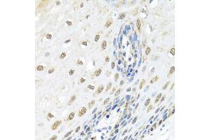 Immunohistochemistry of paraffin-embedded human esophagus using ELAC2 antibody (ABIN5974286) at dilution of 1/100 (40x lens). (ELAC2 抗体)