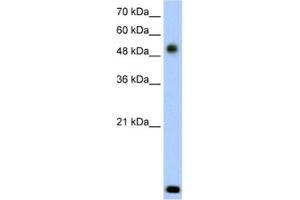 Western Blotting (WB) image for anti-Radical S-Adenosyl Methionine Domain Containing 2 (RSAD2) antibody (ABIN2462622) (RSAD2 抗体)
