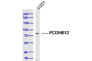 U251 lysates probed with PCDHB12 Polyclonal Antibody, Unconjugated  at 1:300 dilution and 4˚C overnight incubation. (PCDHB12 抗体  (AA 121-220))