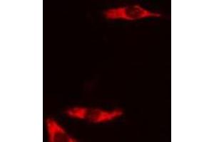 ABIN6278588 staining COLO205 cells by IF/ICC. (GAL4 抗体  (N-Term))