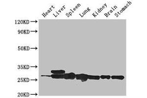 Western Blot Positive WB detected in: Mouse heart tissue, Mouse liver tissue, Mouse spleen tissue, Mouse lung tissue, Mouse kidney tissue, Mouse brain tissue, Mouse stomach tissue All lanes: SWI5 antibody at 3 μg/mL Secondary Goat polyclonal to rabbit IgG at 1/50000 dilution Predicted band size: 27 kDa Observed band size: 27, 29 kDa (SWI5 抗体  (AA 54-112))