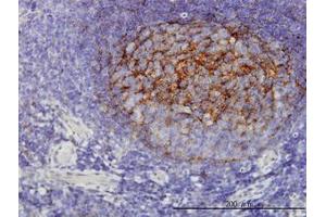 Image no. 1 for anti-Quinolinate Phosphoribosyltransferase (QPRT) (AA 198-298) antibody (ABIN599197) (QPRT 抗体  (AA 198-298))