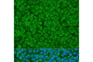 Immunofluorescence analysis of U2OS cells using GOSR1 Polyclonal Antibody at dilution of 1:100. (GS28 抗体)