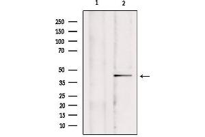 Western blot analysis of extracts from mouse brain, using CCDC109A Antibody. (MCU 抗体  (Internal Region))