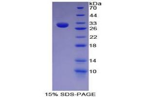 SDS-PAGE analysis of Mouse HAT1 Protein. (HAT1 蛋白)