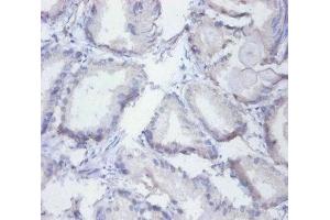 Immunohistochemistry of paraffin-embedded human prostate tissue using ABIN7155134 at dilution of 1:100 (SYNCRIP 抗体  (AA 2-191))