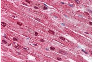 Human Heart (formalin-fixed, paraffin-embedded) stained with SPTLC2 antibody ABIN790286 at 5 µg/ml followed by biotinylated goat anti-rabbit IgG secondary antibody ABIN481713, alkaline phosphatase-streptavidin and chromogen. (SPTLC2 抗体  (AA 548-562))