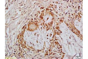 Immunohistochemistry (IHC) image for anti-Metastasis Associated in Colon Cancer 1 (MACC1) (AA 761-852) antibody (ABIN706526)