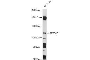 Western blot analysis of extracts of rat brain, using FBXO10 antibody (ABIN7267084) at 1:1000 dilution. (FBXO10 抗体  (AA 1-180))