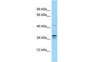 Western Blotting (WB) image for anti-Ubiquitin-Like Modifier Activating Enzyme 5 (UBA5) (N-Term) antibody (ABIN2783950) (UBA5 抗体  (N-Term))