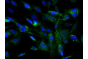 Immunofluorescence (Cultured Cells) (IF (cc)) image for anti-Mast/stem Cell Growth Factor Receptor (KIT) (AA 350-440) antibody (ABIN1387260)