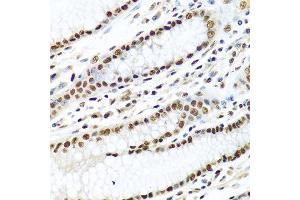 Immunohistochemistry of paraffin-embedded human stomach using METTL3 antibody at dilution of 1:100 (40x lens). (METTL3 抗体)