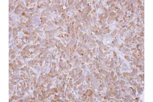 IHC-P Image Immunohistochemical analysis of paraffin-embedded MDA-MB-231 xenograft, using Profilin 1, antibody at 1:500 dilution. (PFN1 抗体)