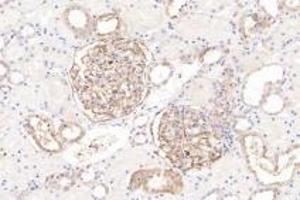 Immunohistochemistry analysis of paraffin-embedded human kidney using Integrin alpha V (ABIN7074314) at dilution of 1: 1000 (CD51 抗体)