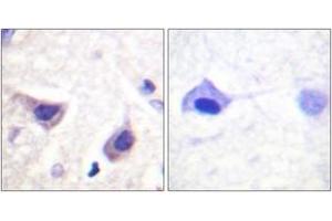 Immunohistochemistry analysis of paraffin-embedded human brain tissue, using JAK3 (Ab-785) Antibody. (JAK3 抗体  (AA 751-800))