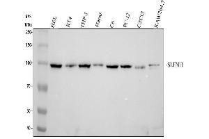 anti-Schlafen Family Member 13 (SLFN13) (AA 62-797) antibody