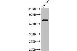 Western Blot Positive WB detected in: Jurkat whole cell lysate All lanes: SLC38A9 antibody at 3. (SLC38A9 抗体  (AA 1-119))
