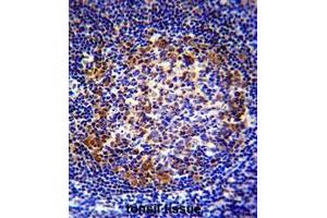 Immunohistochemistry (Paraffin-embedded Sections) (IHC (p)) image for anti-Paired Box 5 (PAX5) (AA 185-215), (Middle Region) antibody (ABIN954009)