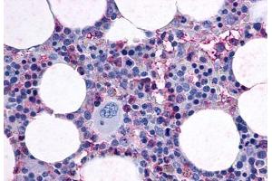 Anti-F2RL3 / PAR4 antibody  ABIN1048594 IHC staining of human bone marrow. (F2RL3 抗体  (Cytoplasmic Domain))