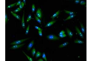 Immunofluorescence staining of Hela cells with ABIN7152610 at 1:100, counter-stained with DAPI. (Fatty Acid Synthase 抗体  (AA 2155-2495))