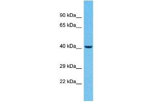 Host:  Rabbit  Target Name:  ZNF232  Sample Type:  Breast Tumor lysates  Antibody Dilution:  1. (ZNF232 抗体  (C-Term))