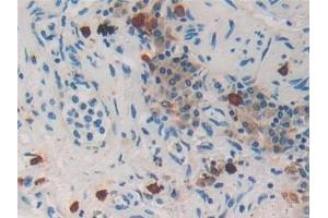 Immunohistochemistry (IHC) image for anti-Protease, serine, 2 (Trypsin 2) (PRSS2) (AA 24-241) antibody (ABIN7433747)