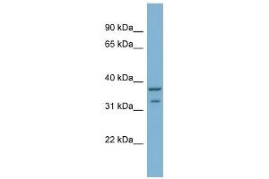 WB Suggested Anti-RALGPS2 Antibody Titration: 0. (RALGPS2 抗体  (C-Term))