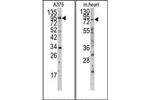Image no. 1 for anti-Myosin Light Chain Kinase (MYLK) (N-Term) antibody (ABIN360382) (MYLK 抗体  (N-Term))