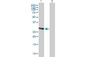 Western Blot analysis of C21orf7 expression in transfected 293T cell line by C21orf7 MaxPab polyclonal antibody.