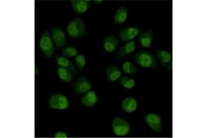 Immunocytochemistry staining of HeLa cells fixed with 4 % Paraformaldehyde and using TBLR1 mouse mAb (dilution 1:200). (TBL1XR1 抗体)