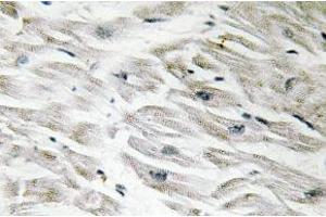 Immunohistochemistry (IHC) analyzes of CPI-17 antibody in paraffin-embedded human heart tissue. (CPI-17 抗体)
