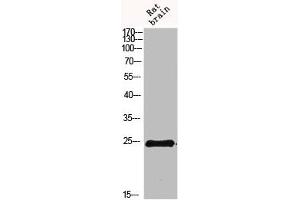 Western blot analysis of 293T Hela VEC KB mouse-kidney lysate, antibody was diluted at 500. (IL-19 抗体  (AA 51-100))
