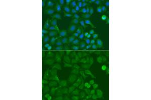 Immunofluorescence analysis of A549 cells using SSX5 antibody. (SSX5 抗体)