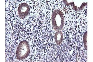 Image no. 6 for anti-Cancer/testis Antigen 1B (CTAG1B) antibody (ABIN1499894) (CTAG1B 抗体)
