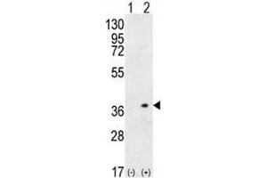 Western blot analysis of HLA-DQA1 antibody and 293 cell lysate (2 ug/lane) either nontransfected (Lane 1) or transiently transfected (2) with the HLA-DQA1 gene.