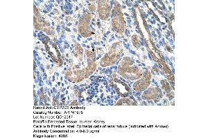 Immunohistochemistry (IHC) image for anti-Cytochrome P450, Family 2, Subfamily D, Polypeptide 6 (CYP2D6) (N-Term) antibody (ABIN2776931)