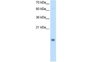 WB Suggested Anti-CSTB Antibody Titration:  0. (CSTB 抗体  (N-Term))