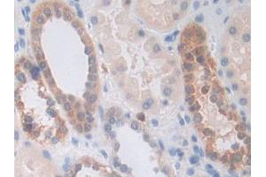 DAB staining on IHC-P; Samples: Human Kidney Tissue (PPIF 抗体  (AA 45-196))