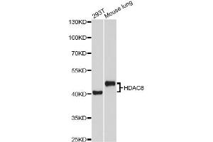 Western blot analysis of extracts of various cell lines, using HDAC8 Antibody (ABIN2563019) at 1:1000 dilution.