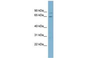 Image no. 1 for anti-Replication Protein A1, 70kDa (RPA1) (AA 215-264) antibody (ABIN6742105) (RPA1 抗体  (AA 215-264))