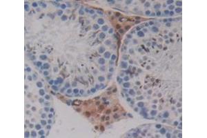 Used in DAB staining on fromalin fixed paraffin- embedded Kidney tissue (PPHLN1 抗体  (AA 1-381))
