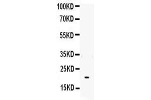 Western blot analysis of IL-6 using anti- IL-6 antibody . (IL-6 抗体  (AA 29-212))