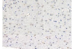 ABIN6265048 and ABIN6279809 at 1/100 staining Rat brain tissue by IHC-P.
