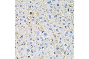 Immunohistochemistry of paraffin-embedded mouse liver using Tau antibody (ABIN3021441, ABIN3021442, ABIN3021443 and ABIN6215045) at dilution of 1:100 (40x lens). (MAPT 抗体  (AA 1-100))